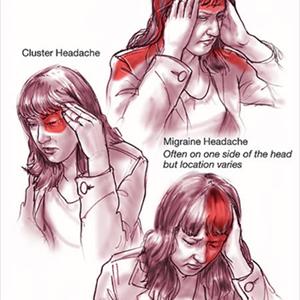 Extreme Migraine - Is This A Migraine Headache?