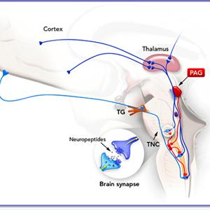 Migraine Triggers Food - Migraine Remedies