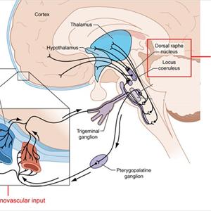 Analgesicabuse Headache - General Factors That Could Trigger Off An Attack